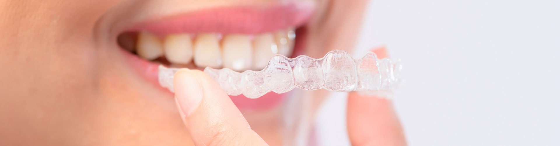 Woman placing clear aligner in her mouth.